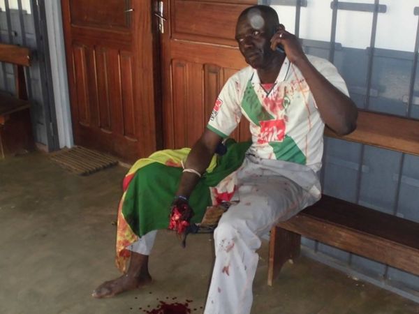 Une victime de la répression lors d'une manifestation pacifique le 29 août dernier. La victime a la main droite déchiqueté pa