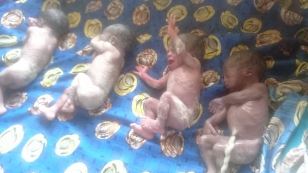 Tchad : une mère donne naissance à des quadruplés au Guera