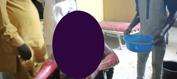 Tchad : un jeune entrepreneur gravement brûlé à Koumra après l’explosion d’un stock de carburant