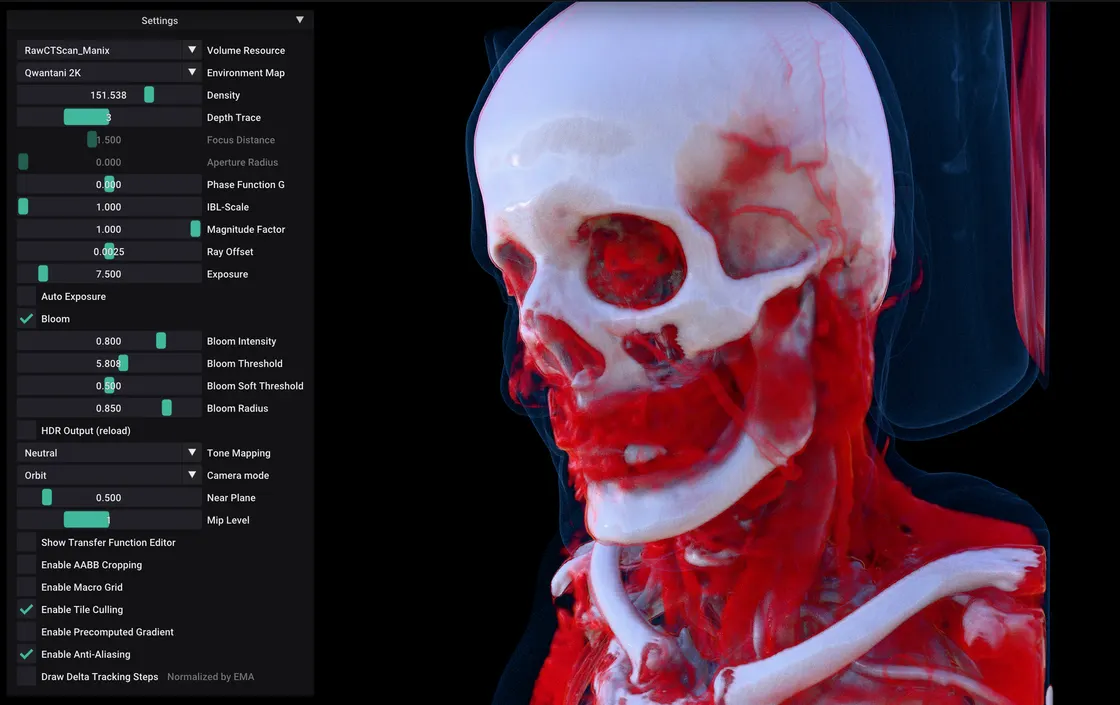 Grenzwert: Path-Traced Volumetric CT Rendering in WebGPU