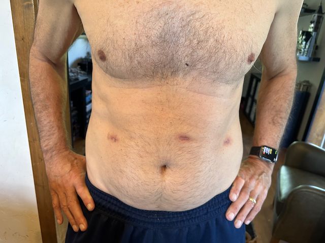 Begin the dream again - again