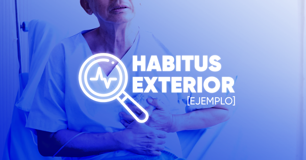habitus exterior ejemplo