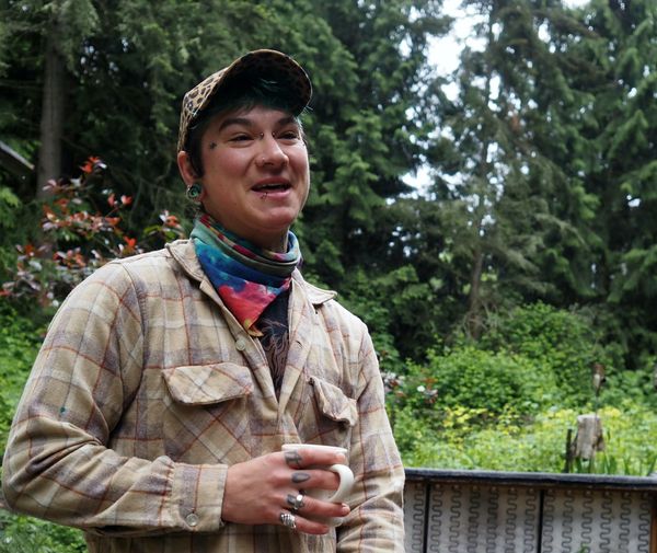 Surgery as service to self and others: Local trans community thrives through mutual aid