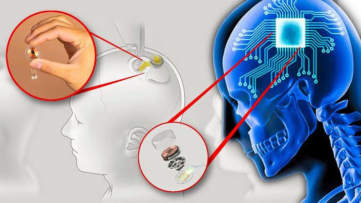 Journey into the Mind: The Groundbreaking Progress of Neuralink