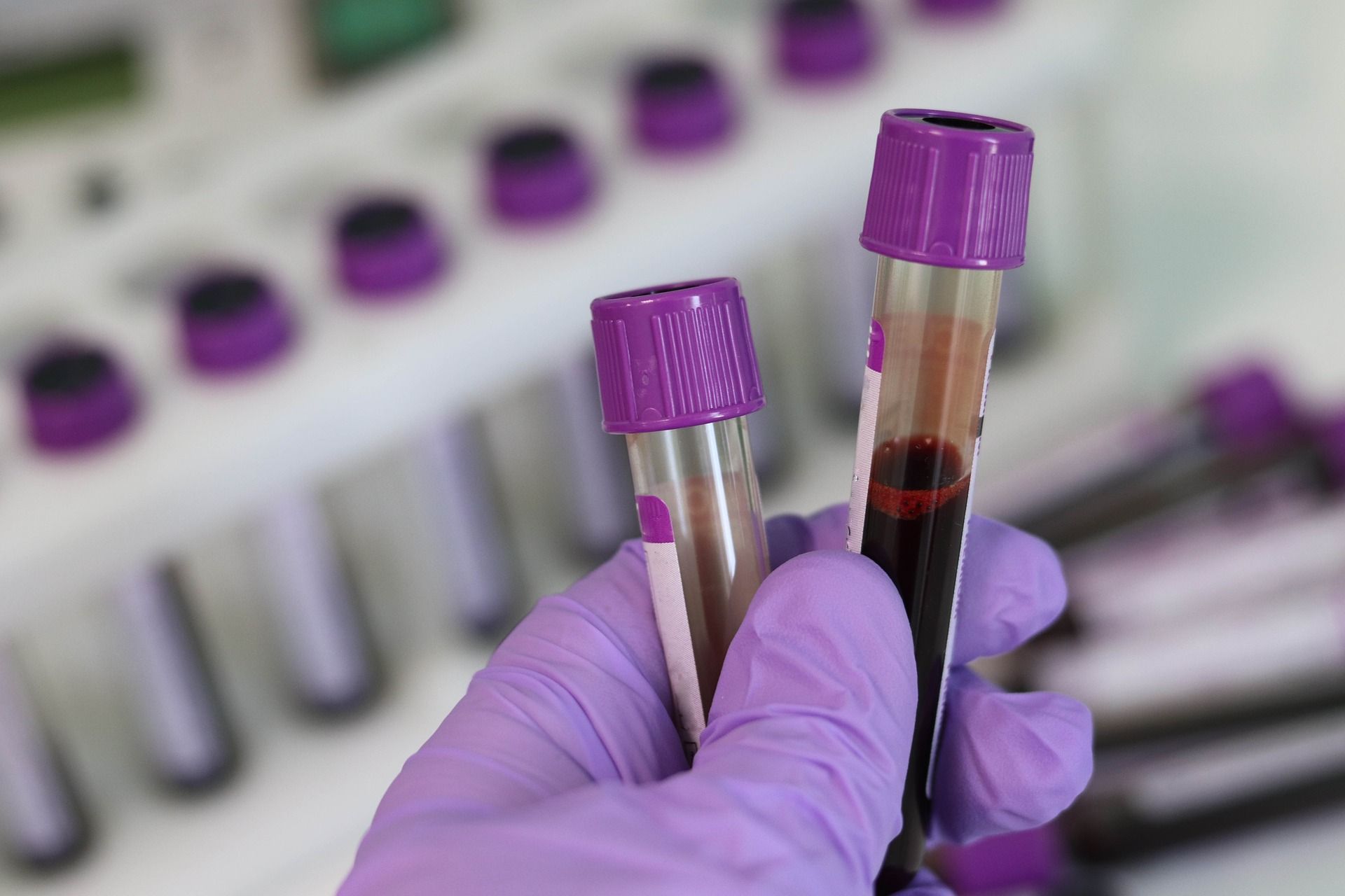 💉 Blodprov kan visa om MS-sjuka är på väg att bli sämre