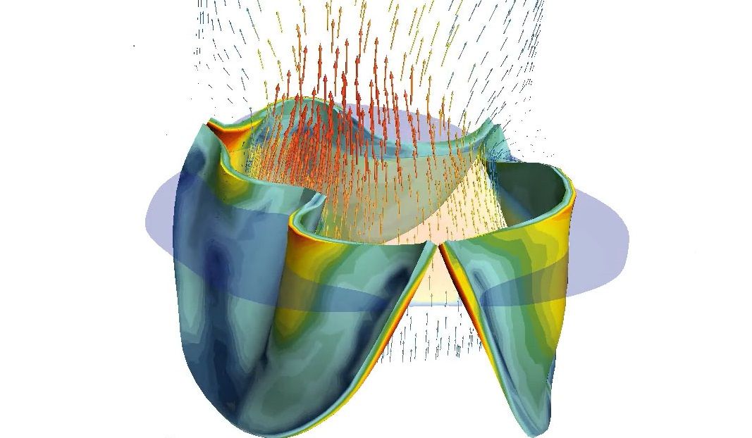 💖 Visualisering ska ge bättre och säkrare hjärtoperationer