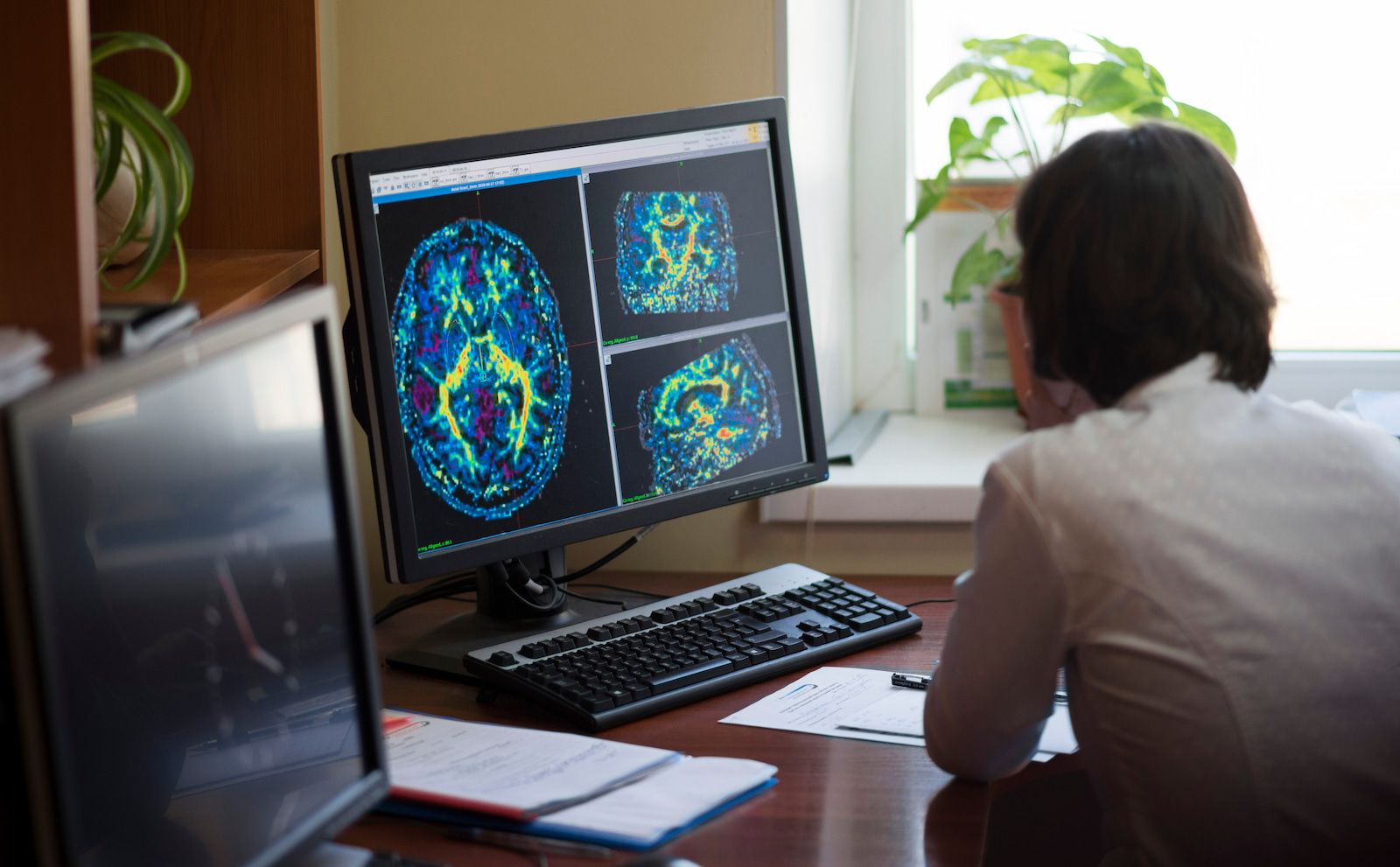🧠 Skarpaste bilden någonsin av en hjärna