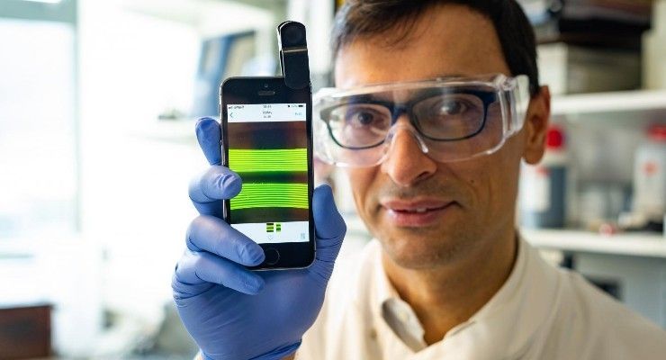 📱 Mobiltelefonens kamera kan diagnostisera urinvägsinfektion