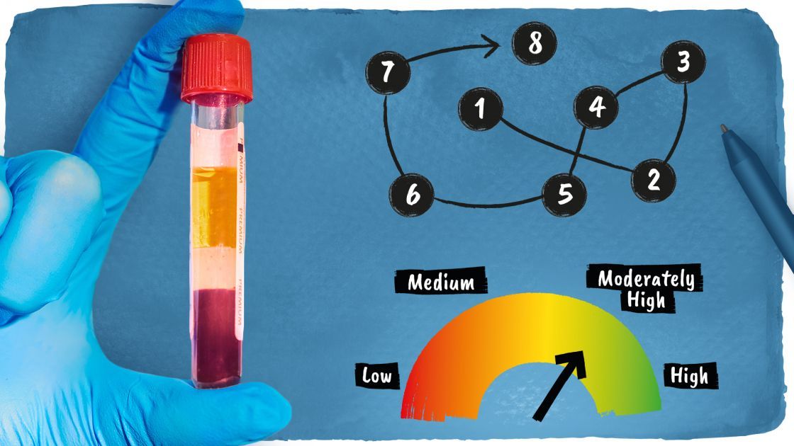 🔬 Snabbt och billigt test kan förutsäga vem som kommer att få Alzheimers sjukdom