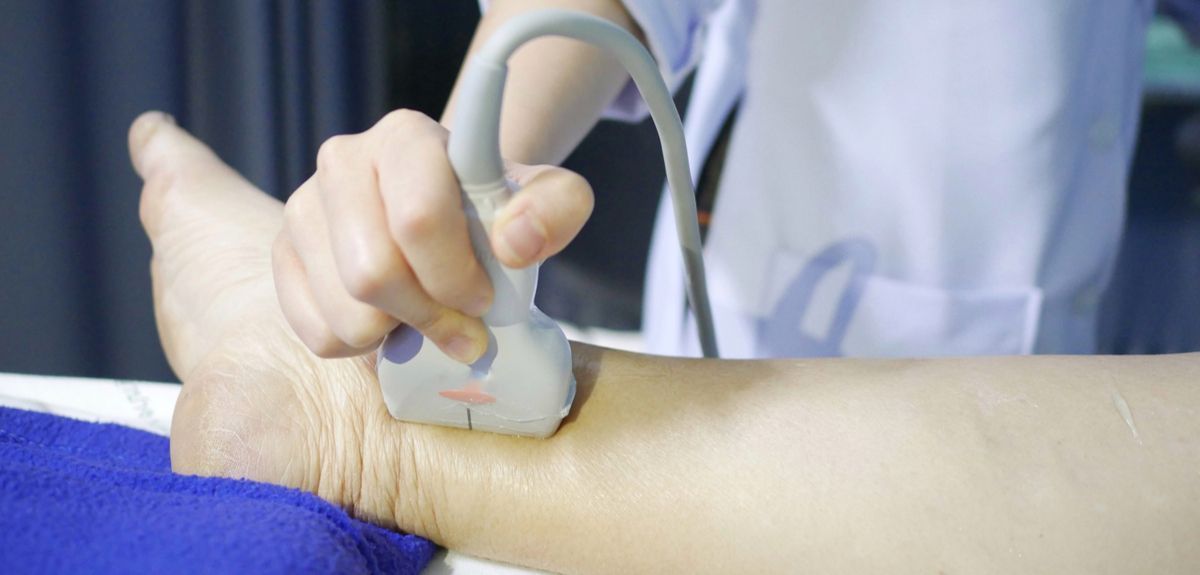 🦿 AI hittar blodproppar i benen