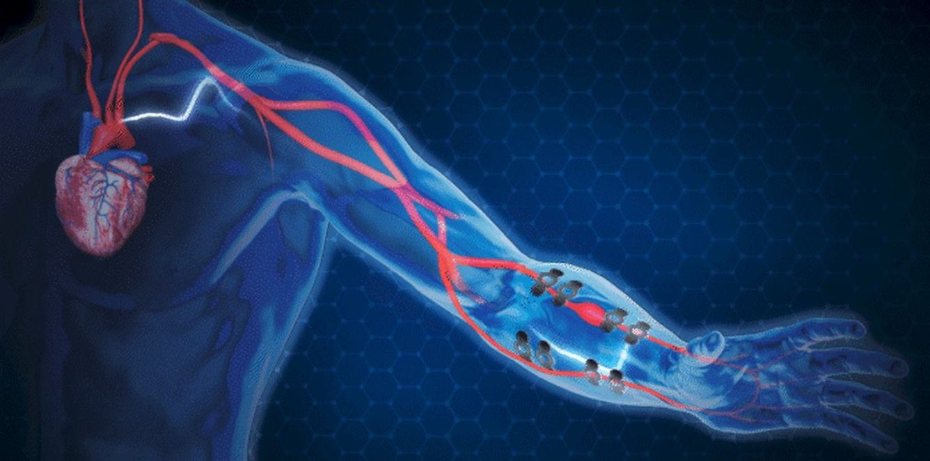 🩺 E-tatuering håller koll på ditt blodtryck