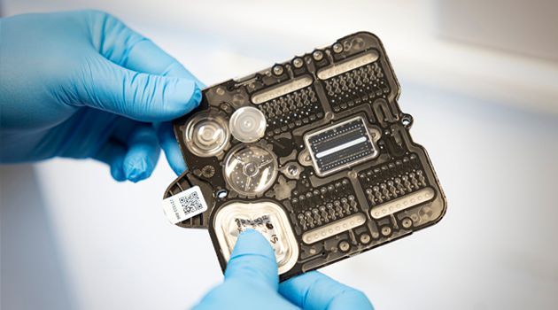 🧫 Snabbare analys ger tidigare behandling av urinvägsinfektion