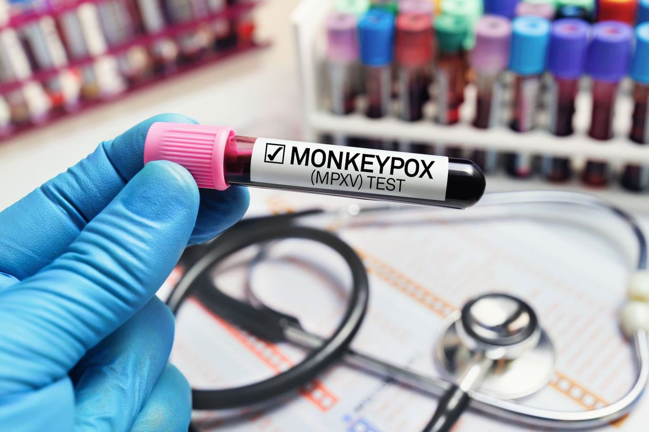🐒 Apkoppor (monkeypox) inte längre globalt nödläge