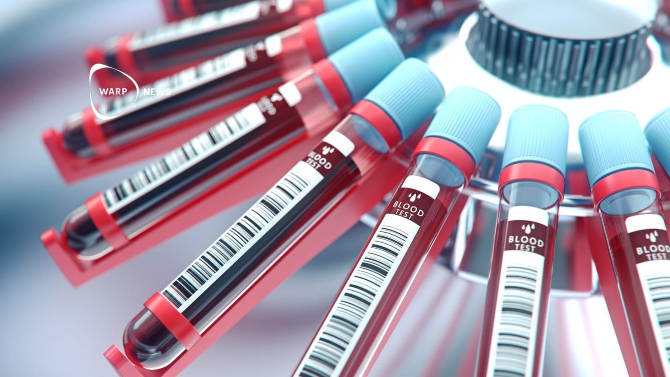 🩸 Ny blodprovsteknik blir verklighet, trots Theranos-skandalen