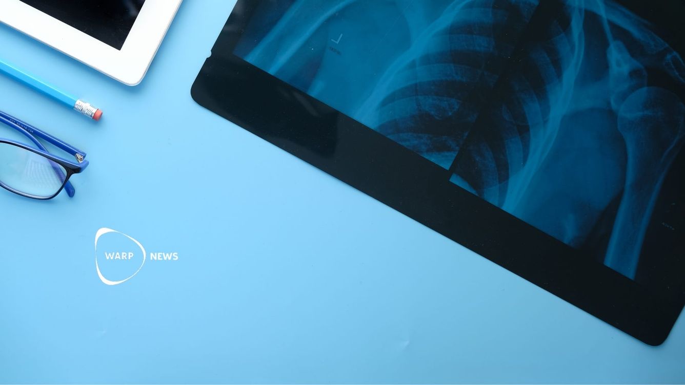 🩺 AI diagnostiserar bättre än läkare i test