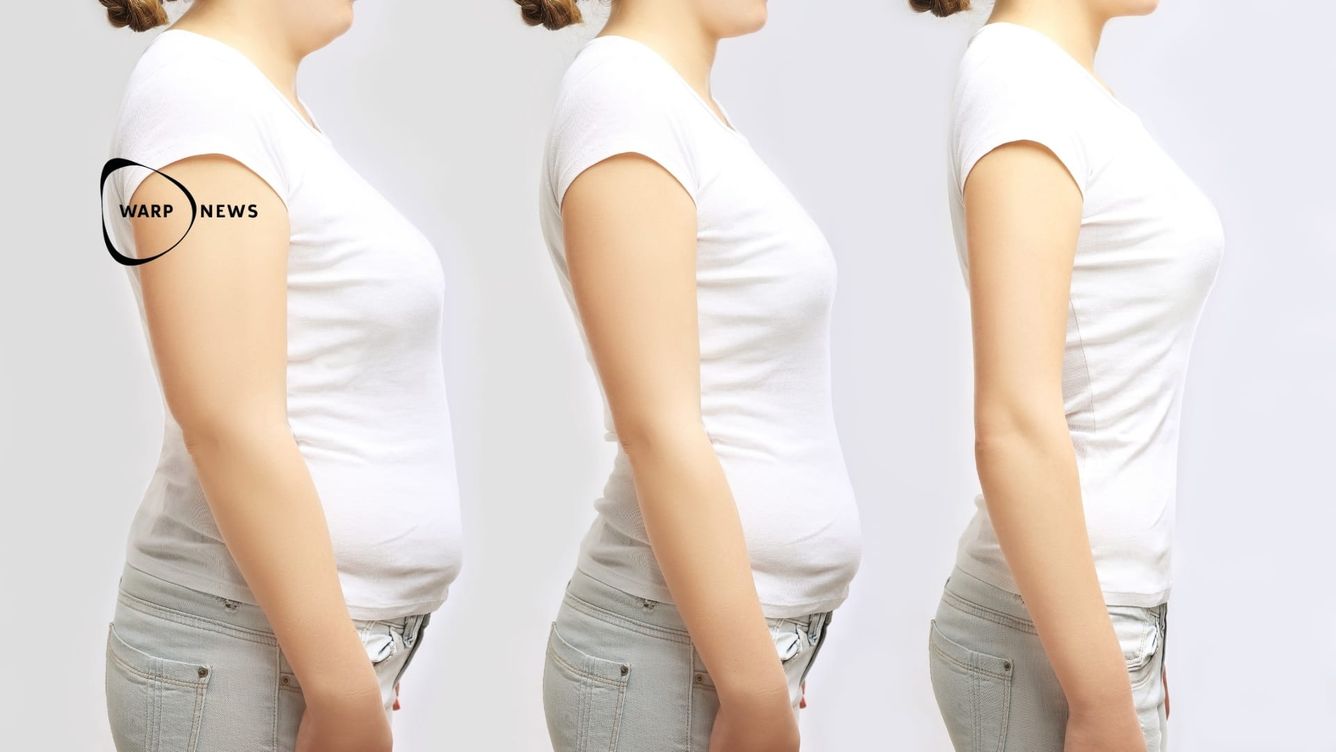 🤰 Nytt fetmaläkemedel ger högsta viktminskningen hittills i klinisk studie