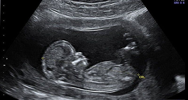 Bioethicist: ‘We have commodified … babies and baby parts’