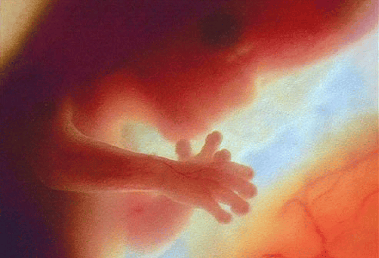 20-Weeks Abortion Restriction Fails in U.S. Senate