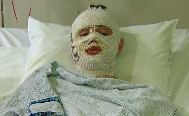US teen describes surviving Boston and Belgium attacks