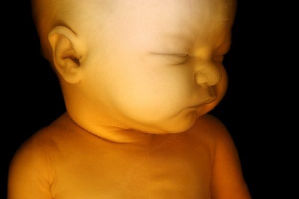 Governor Vetoes Massachusetts Abortion Bill; Opponents Counting Votes
