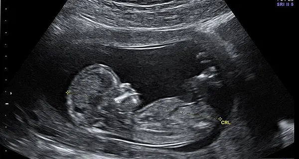 More Abortions In Massachusetts Last Year, Data Shows