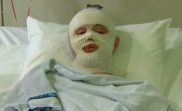 US teen describes surviving Boston and Belgium attacks