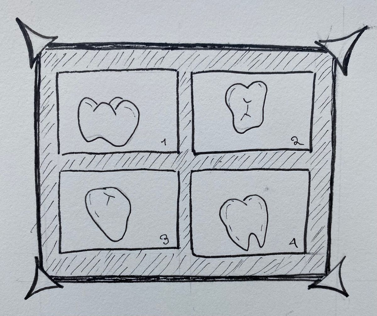 For teeth