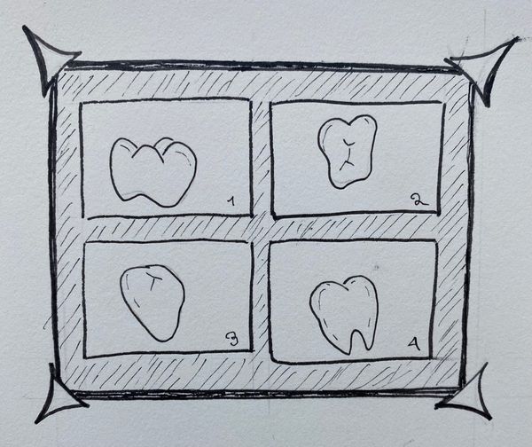For teeth