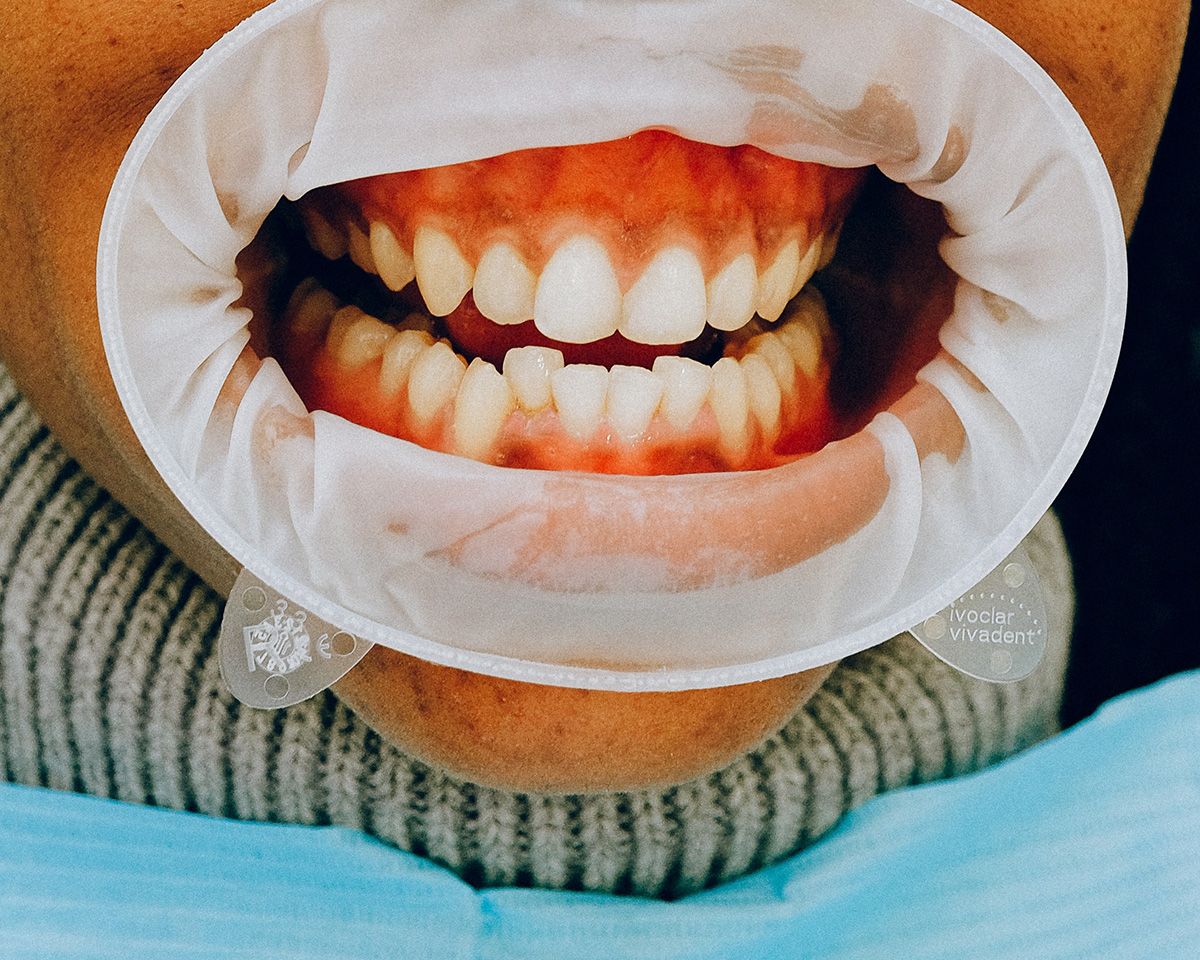 Worms have no teeth. Which means less dentist bills.