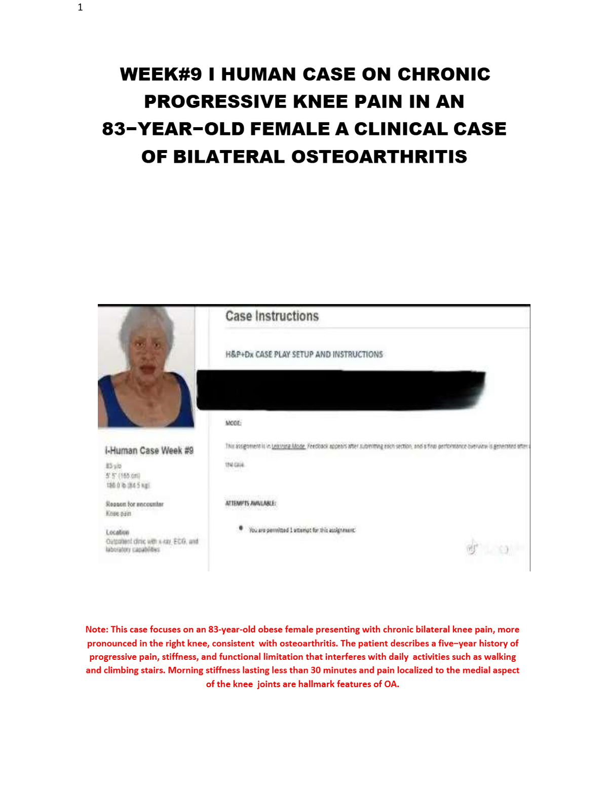 Ihuman Case on Chronic Progressive Knee Pain in an 83-Year-Old Female; A Clinical Case of Bilateral Osteoarthritis -Week#9