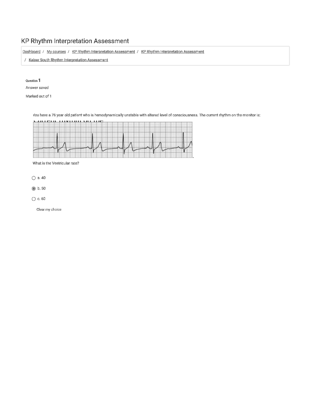 KP Rhythm Interpretation Assessment | 50 Questions and Answers | Latest 2025/2026 Update |, Exams of Nursing