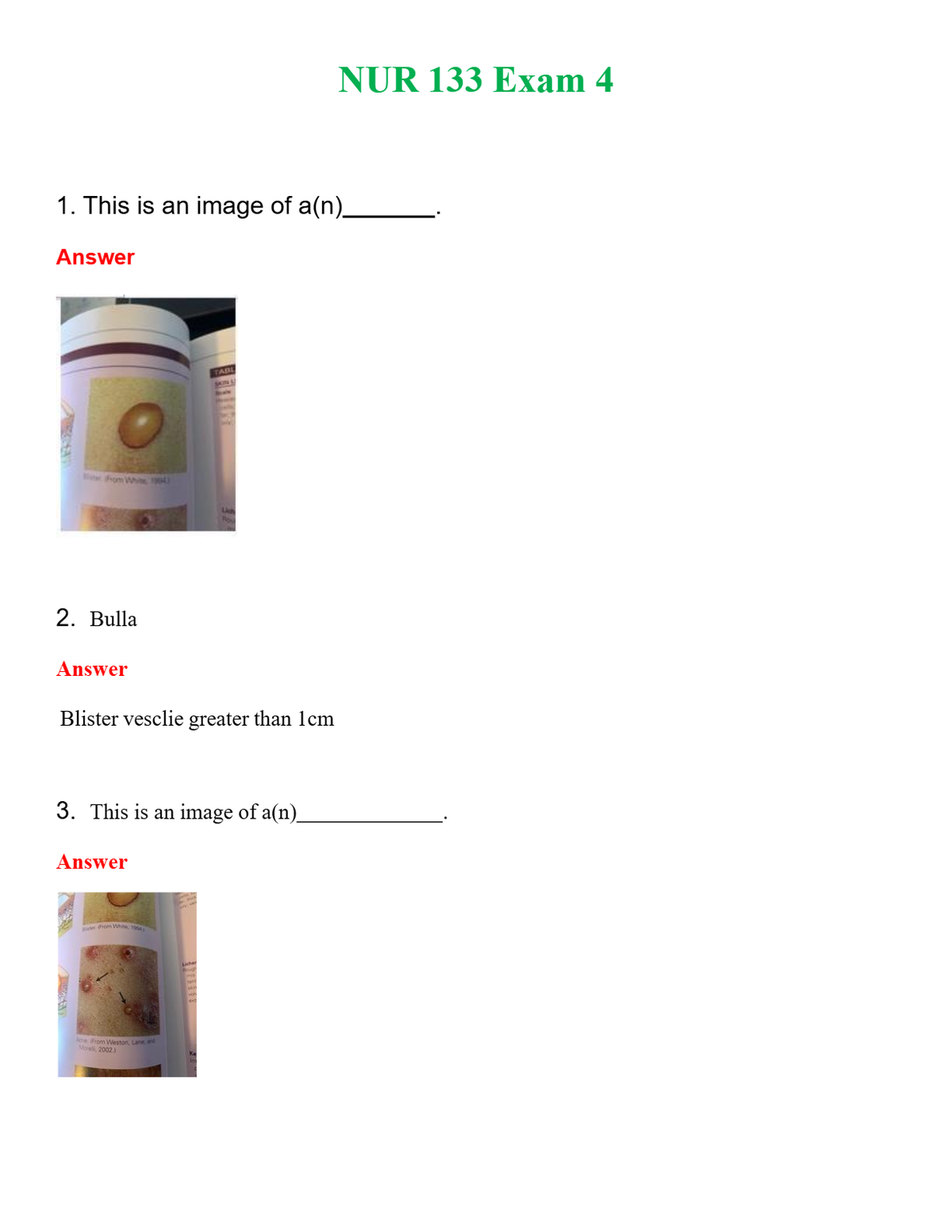 NUR 133 EXAM 4 | QUESTIONS & ANSWERS (SOLVED)
