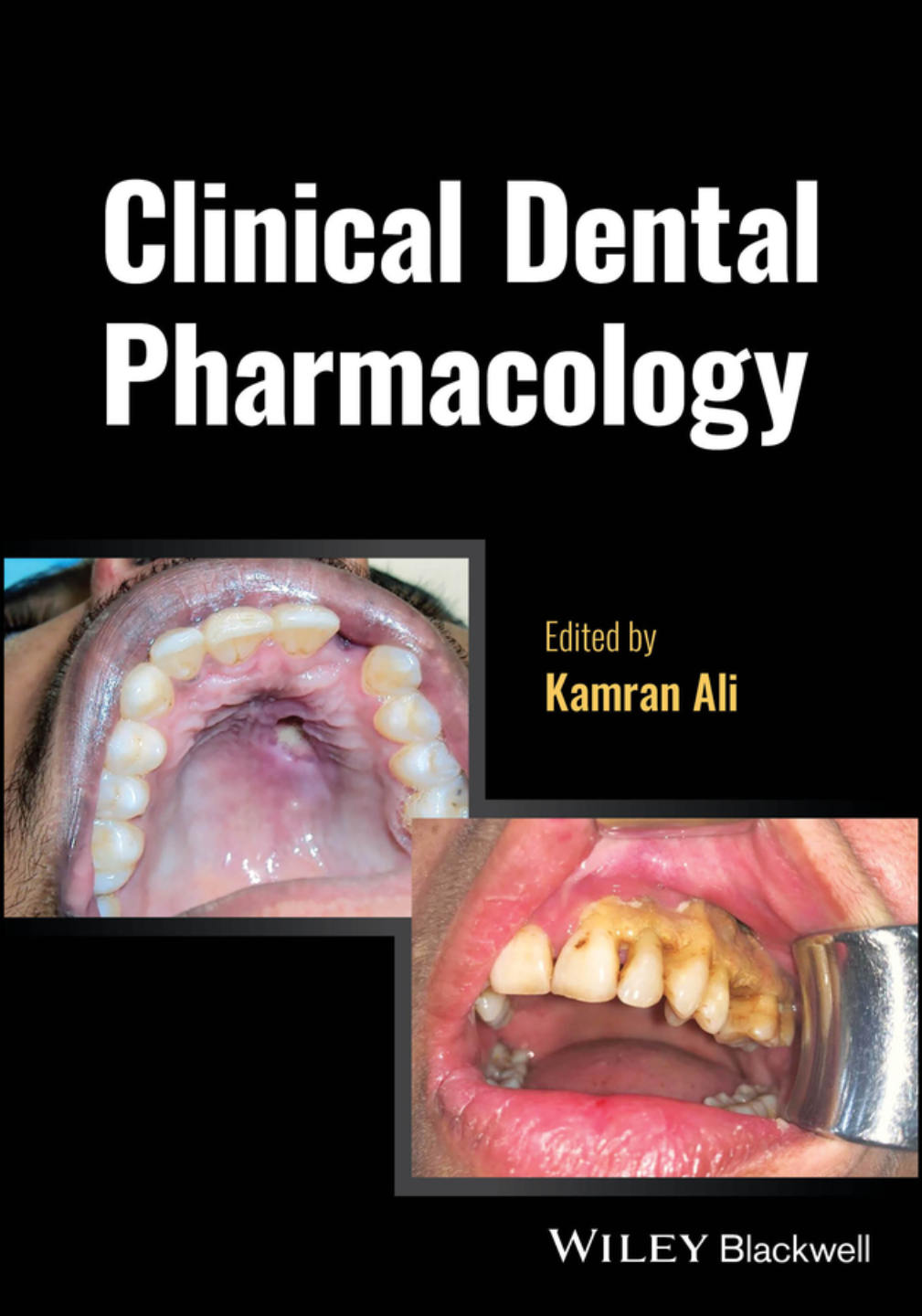 Clinical Dental Pharmacology 1st Edition By Kamran Ali 