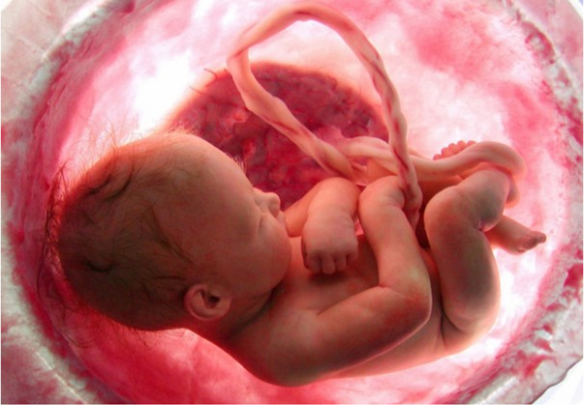 L’aborto, causa principale di morte nel 2019