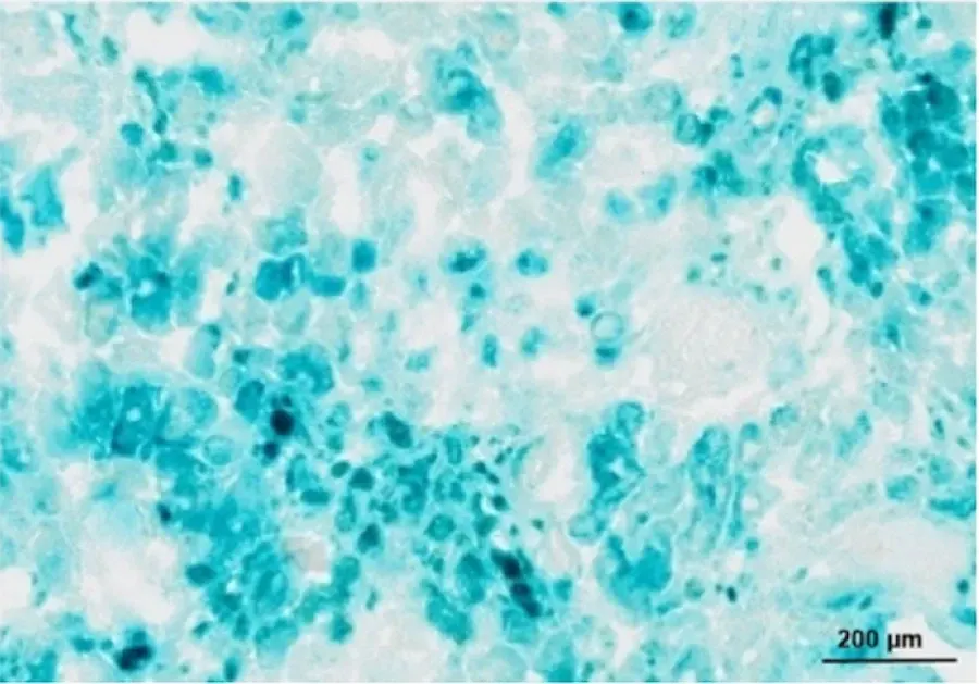Photomicrograph of tissue with cyan-blue β-galactosidase enzymatic staining showing scattered positive cells, 200 micrometer scale bar visible.