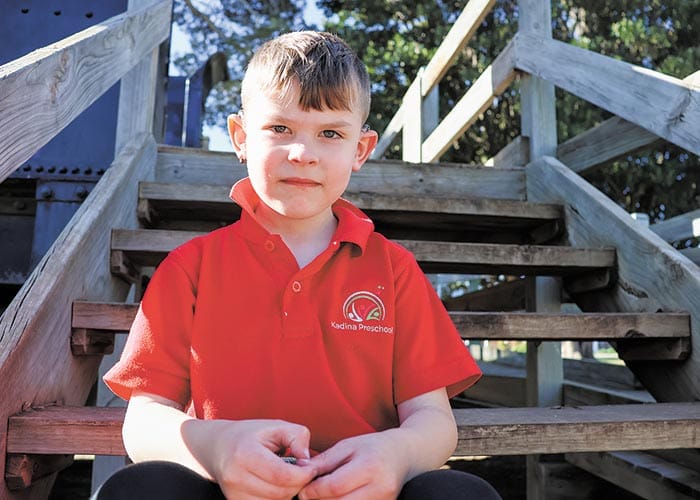 Compensation for cochlear failures