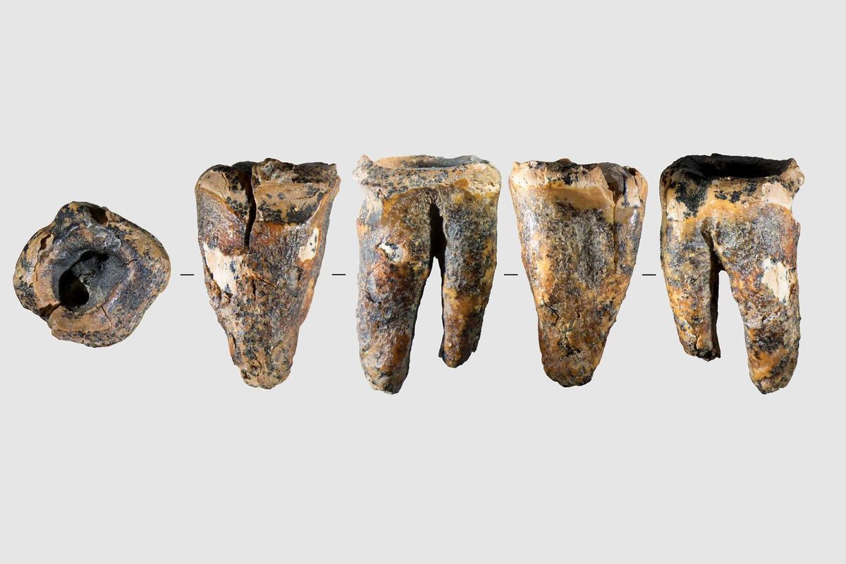 Neanderthal Dentistry
