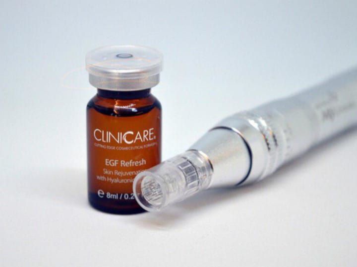 Microneedling - förnyad struktur och ny lyster | 60 min 2095:-