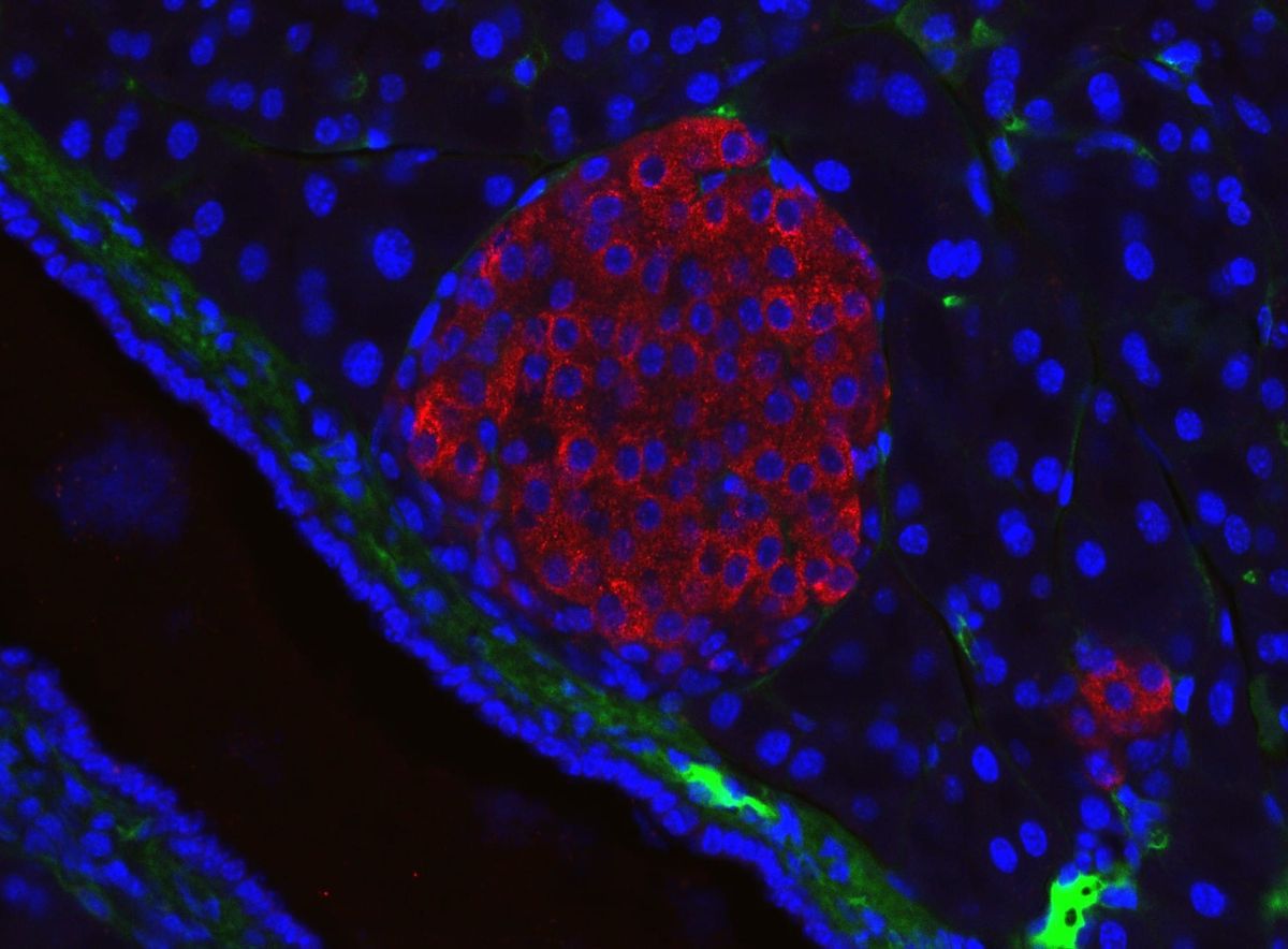 https://commons.wikimedia.org/wiki/File:Mouse_pancreatic_islet.jpg