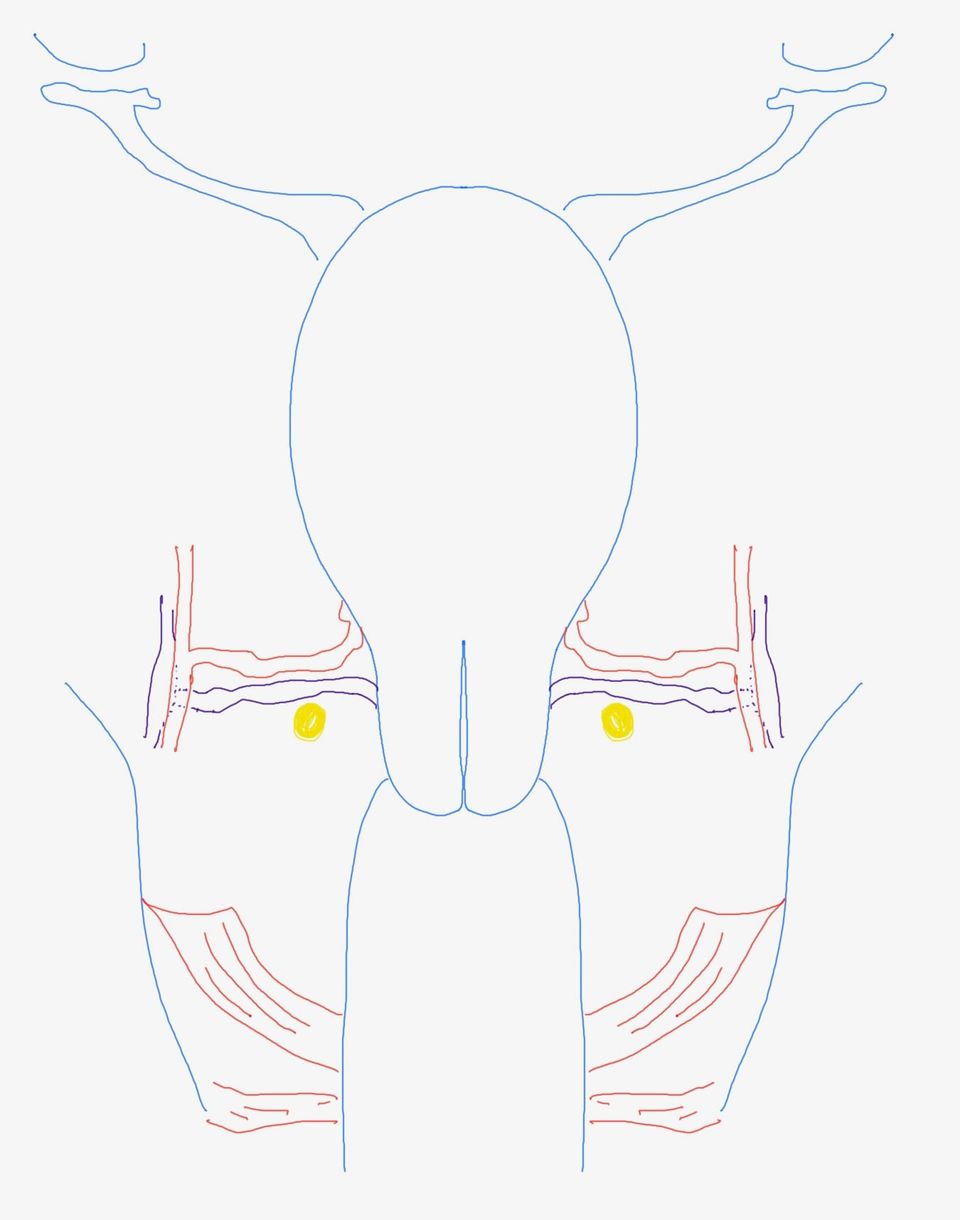 Open Radical Hysterectomy