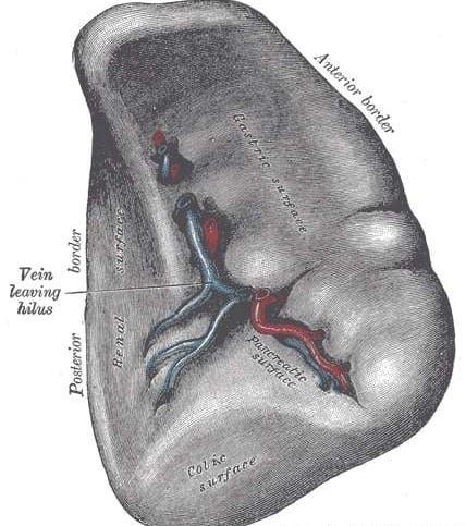 Splenectomy