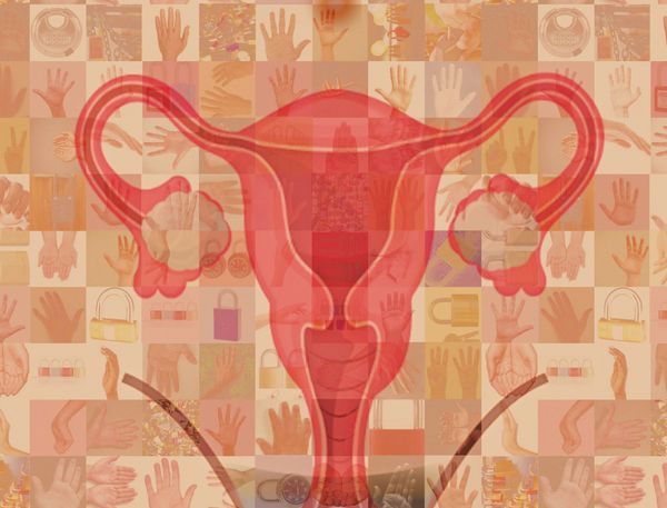 You are not pro-life