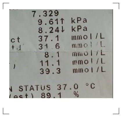 Mentally Predict ABG Results