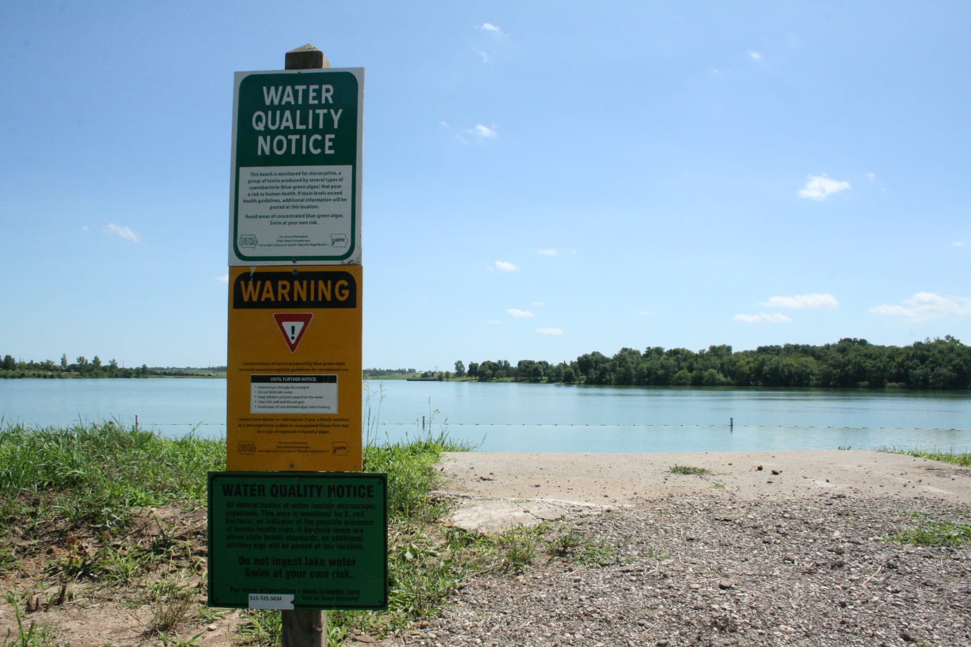 The yellow sign warns visitors to Green Valley State Park of high levels of microcystin, a liver toxin that can cause skin rashes, gastrointestinal issues and, in high doses, can lead to liver failure. Pictured July 31, 2015.