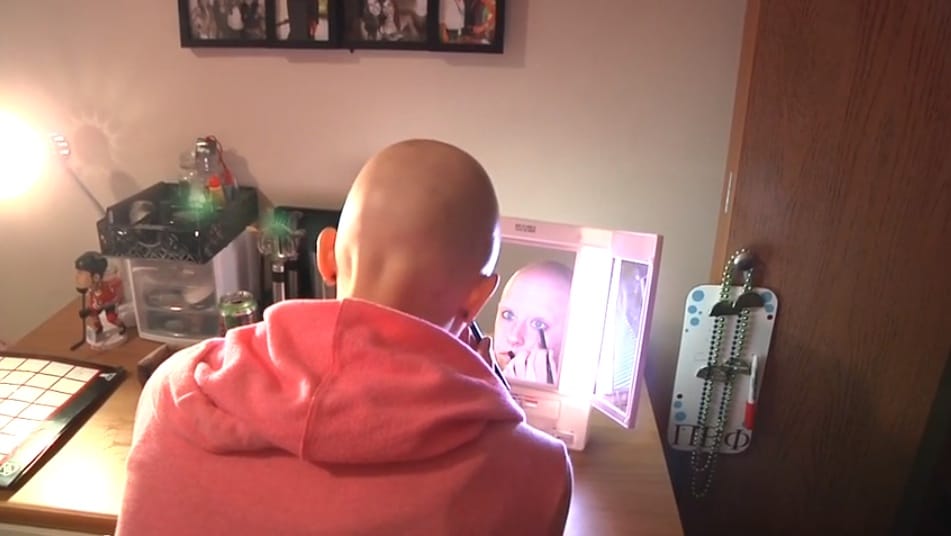 University of Iowa student Taylor Goggin, 21, of Lake Zurich, Ill., applies makeup and prepares to don a wig in May 2014 in Iowa City. Goggin has alopecia, which causes hair loss.