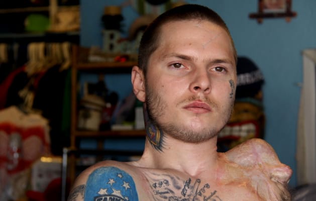 U.S. Army veteran Jerral Hancock, of Lancaster, Calif., drove over an IED in Iraq in 2007. He lost his arm and the use of both legs, and now suffers from post-traumatic stress disorder.