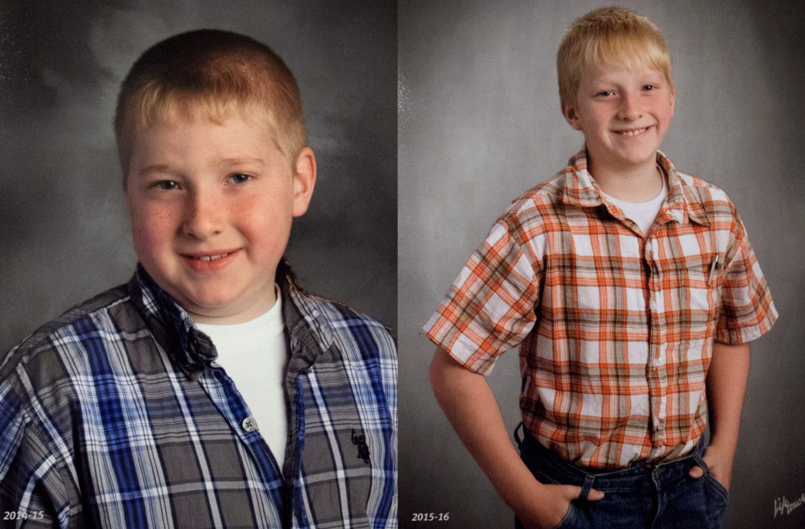 Jacob Reeves' 2014-15 school picture, left, shows the effects of the steroids he was required to take at high levels during treatment for his juvenile dermatomyositis. A year later, after going off the drugs, most of the swelling had gone away.