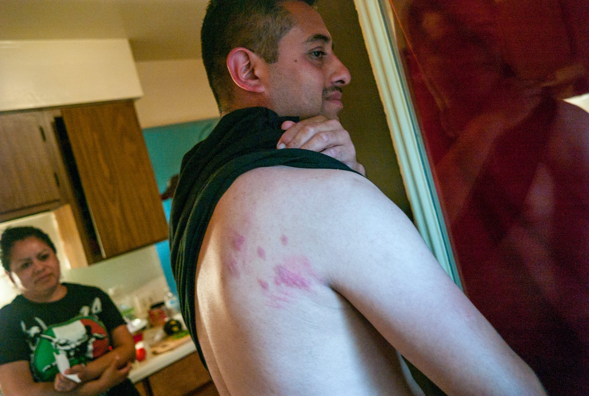 Jose Veja, a 36-year-old from Texas living at the Pine Creek housing facility, pulls up his shirt to show a back covered in beg-bug bites.