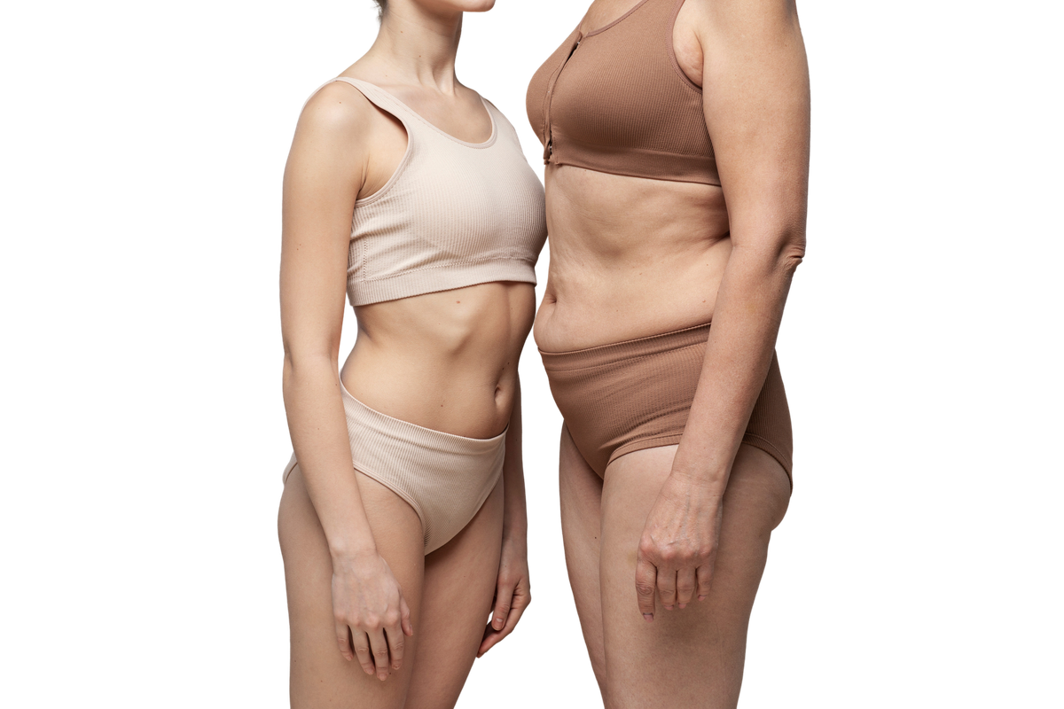 Lipo 360 Before and After: Real Patient Results from Miami (2025 Guide)