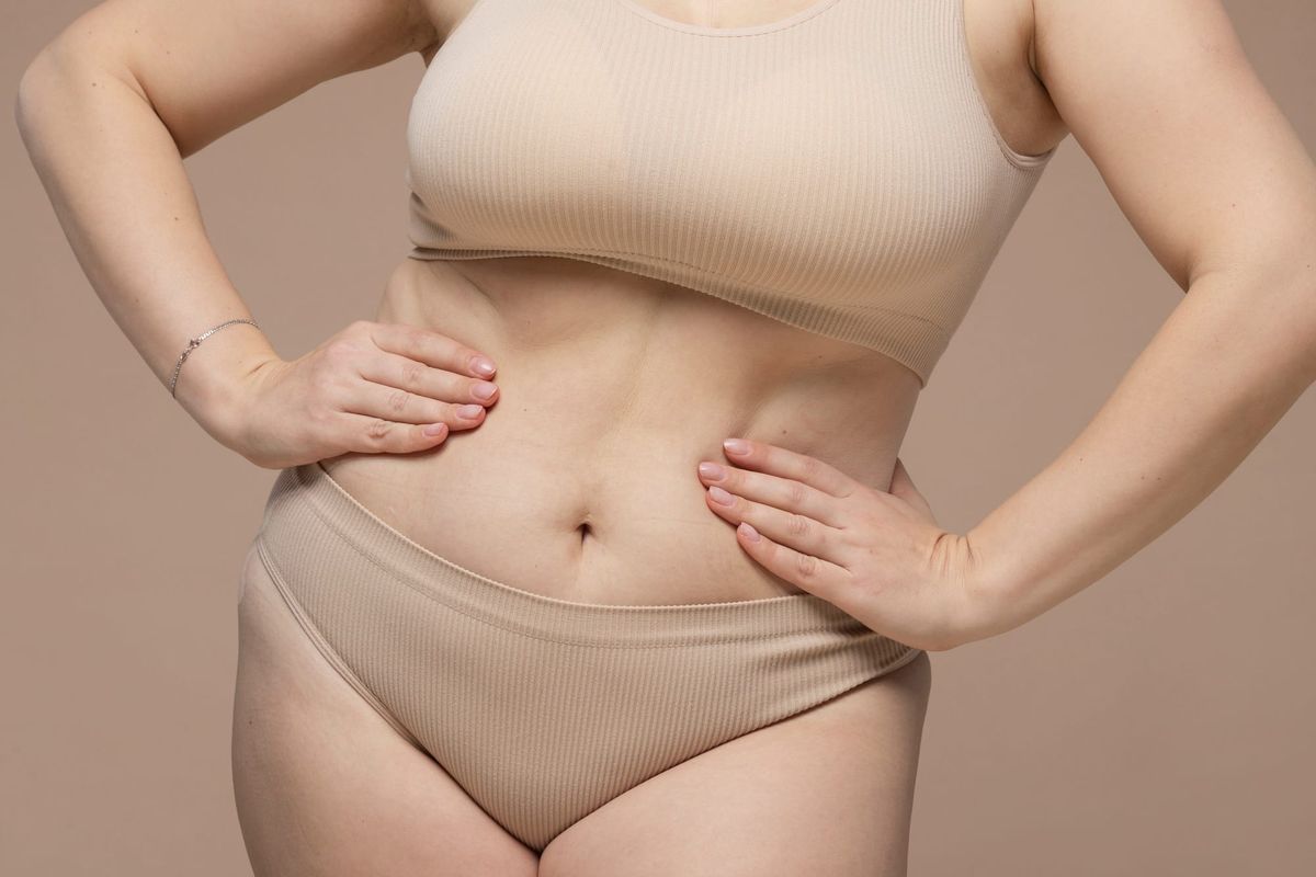Am I a Good Candidate for a Tummy Tuck (Abdominoplasty)?